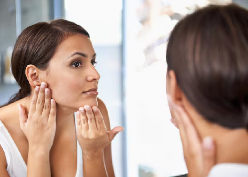Hormonal Skin Issues